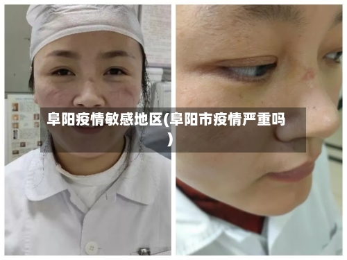 阜阳疫情敏感地区(阜阳市疫情严重吗)-第3张图片